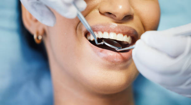 Best Emergency Dental Care for Broken or Chipped Teeth in Sicklerville, NJ